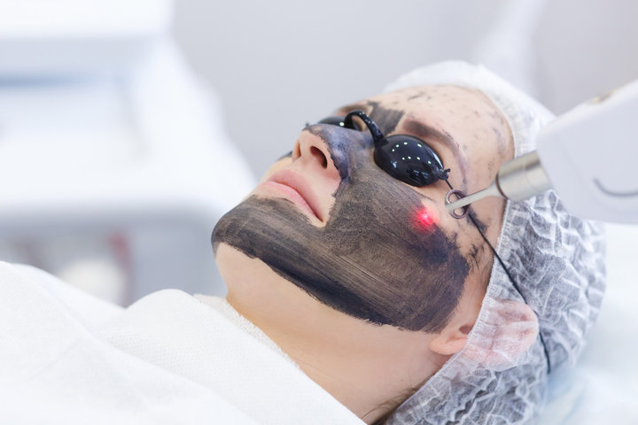 Carbon LASER Facial