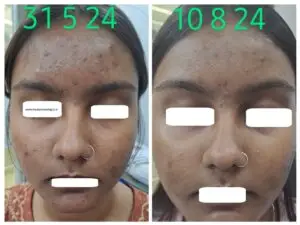 20240810 182857 COLLAGE2 1