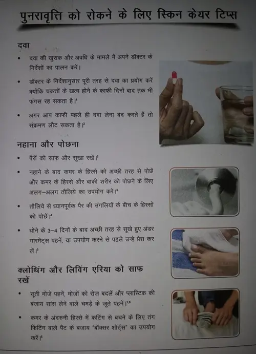 Fungal infection prevention tips